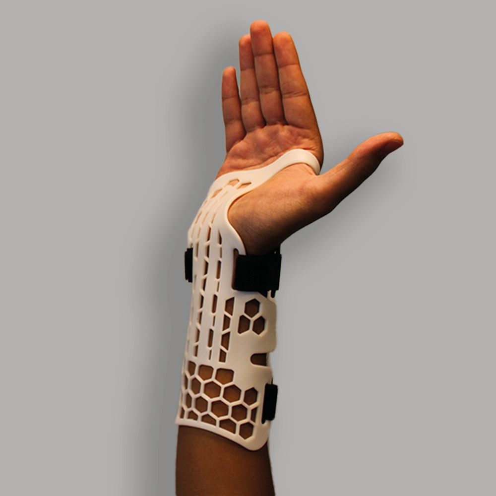 Mithril Cock-Up Splint – BeneCare Direct