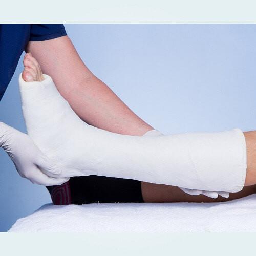 A finished Below Knee POP cast made with Benecast Gold Plaster of Paris.