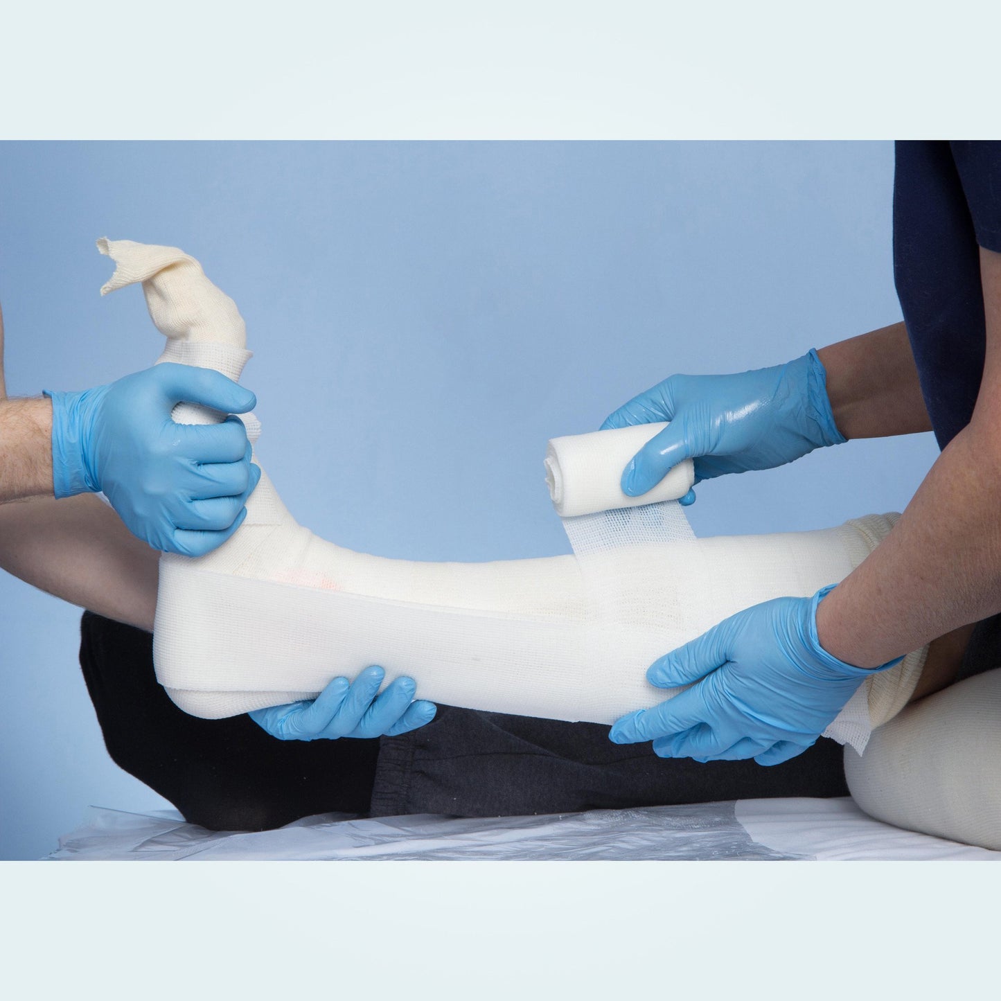 5 Inch BeneCast Advanced Casting Tape
