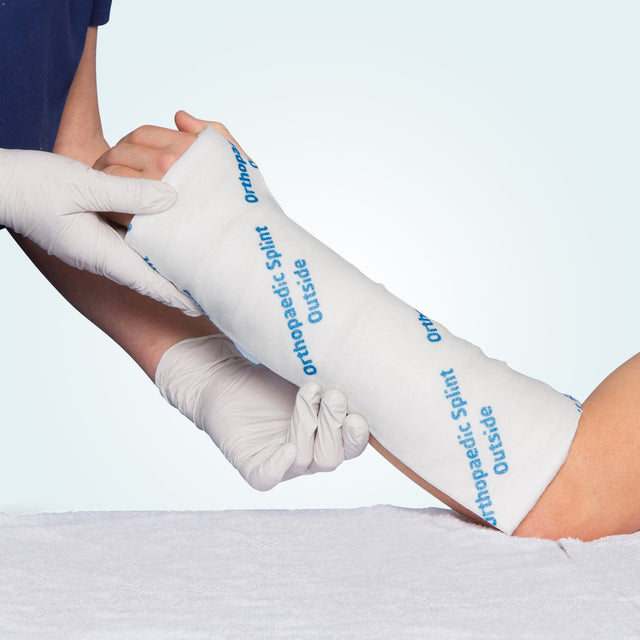 Benecast Splint on a Roll being applied to an arm for a below elbow splint.